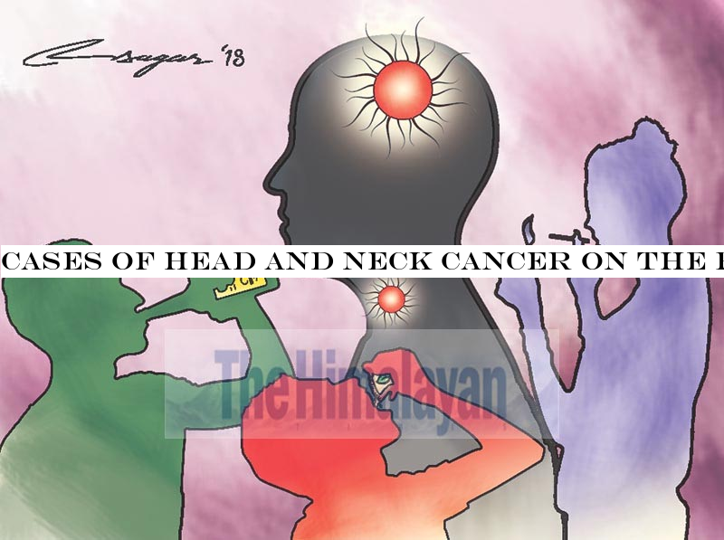 Cases of head and neck cancer on the rise