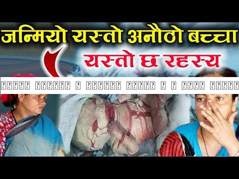 सबैले जान्नु र बुझ्नु जरुरी छ | कसरी जन्मियो यस्तो अनौठो बच्चा ? डक्टरले के भन्छन त ?