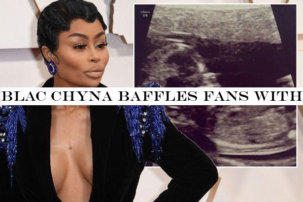 Blac Chyna baffles fans with now deleted 'pregnancy announcement' snap