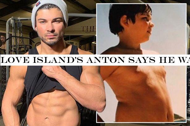 Love Island's Anton says he was an 'overweight' child as he flaunts incredible transformation