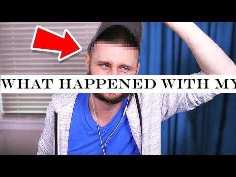 What happened with my HEAD SURGERY