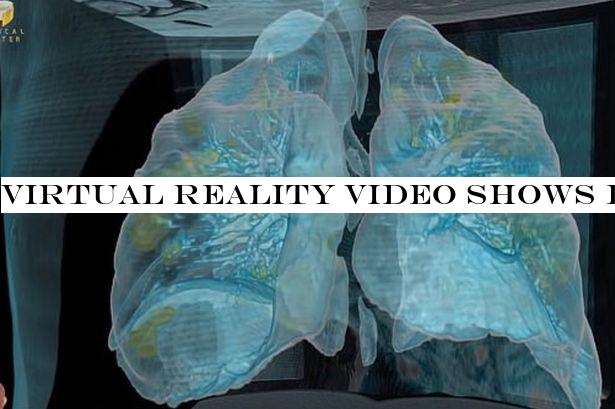 Virtual reality video shows damage coronavirus can cause to lungs within days