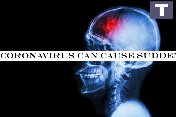 Coronavirus can cause sudden strokes in young adults, doctors warn