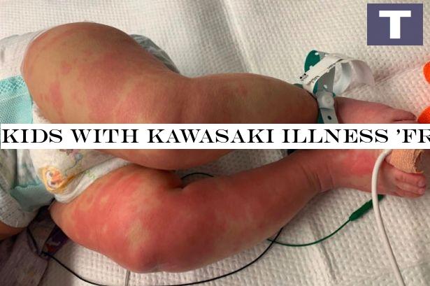 Children with Kawasaki disease 'often not testing positive for coronavirus'