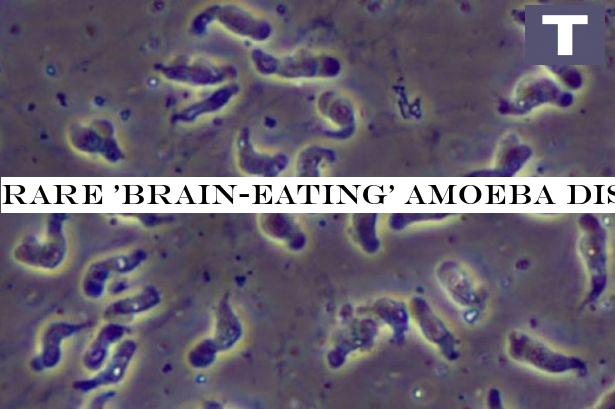 Rare 'brain-eating' amoeba discovered as one man infected, health officials warn