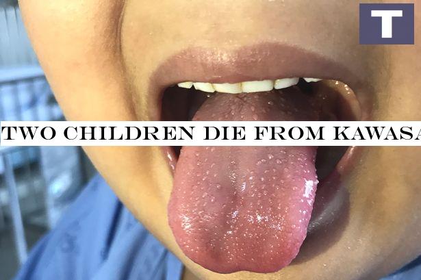 Two children die from Kawasaki-like disease linked to coronavirus in UK